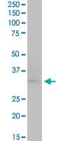Monoclonal Mouse anti-Human CDK4 Antibody (clone 4F11, IF, WB)