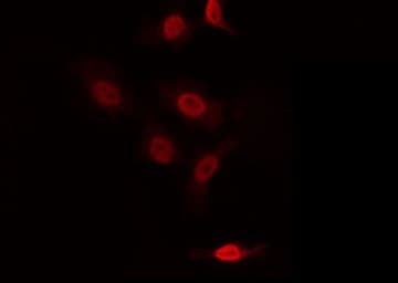 Polyclonal Rabbit anti-Human ZNF287 Antibody (IHC, IF, WB)