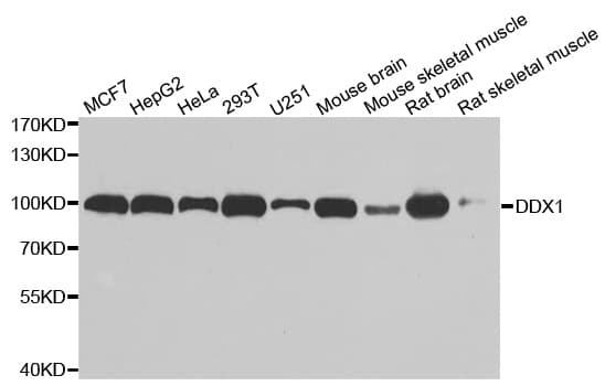Polyclonal Rabbit anti-Human DDX1 Antibody (IHC, IF, WB)