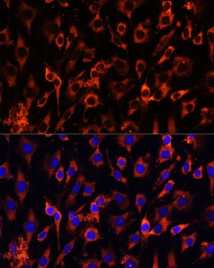 MCTS1 Antibody