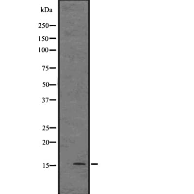 Polyclonal Rabbit anti-Human DNAJC15 Antibody (IHC, WB)