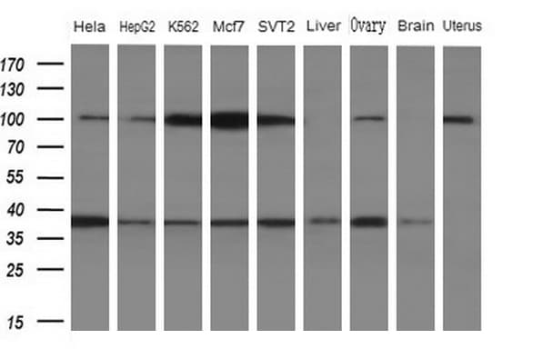 WDR61 Antibody (aa92-305, clone OTI4C4)