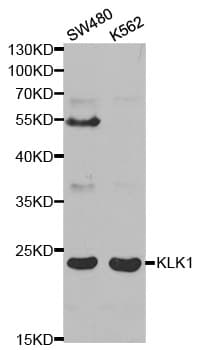 IHC-plus™ Polyclonal Rabbit anti-Human KLK1 / Kallikrein 1 Antibody (IHC, WB)