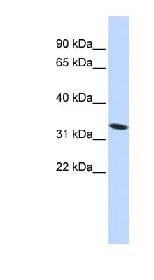 HMG20A Antibody (N-Terminus)