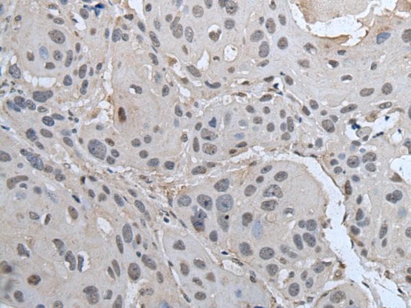SMC1A / SMC1 Antibody