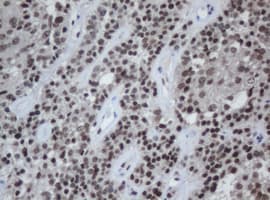 CBX8 Antibody (clone OTI3D1)