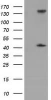 PAICS / ADE2 Antibody (clone OTI5B6)