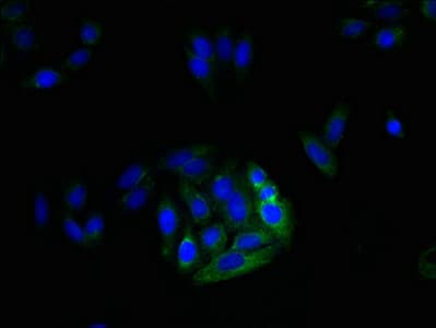 Polyclonal Rabbit anti-Human MRGPRX3 / MRGX3 Antibody