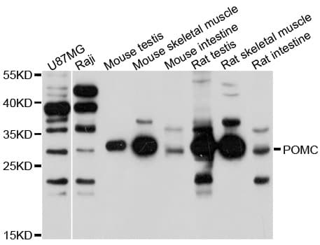 POMC / Proopiomelanocortin Antibody