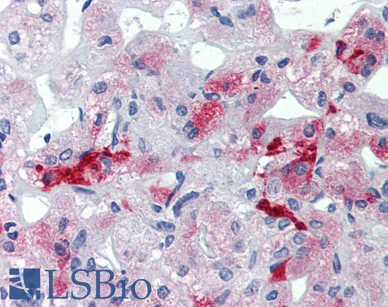 IHC-plus™ Polyclonal Rabbit anti-Human JPH3 Antibody (IHC, IF, WB)