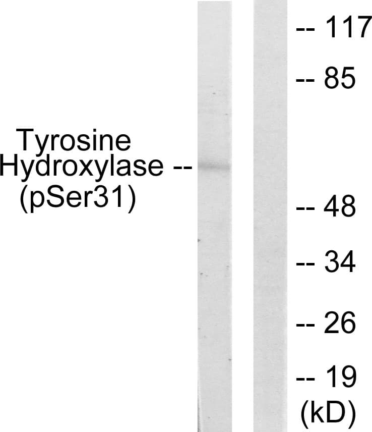 TH / Tyrosine Hydroxylase Antibody (phospho-Ser31)