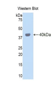 CTSL / Cathepsin L Antibody (aa18-113)