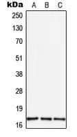 TGFA / TGF Alpha Antibody (Internal)