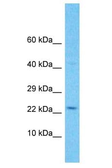 C11orf91 Antibody (aa141-190)