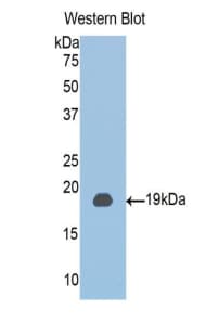CLIC4 Antibody (aa104-253, APC)