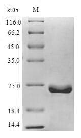 Epstein-Barr Virus BHRF1 Protein (Recombinant 10His, N-terminus)