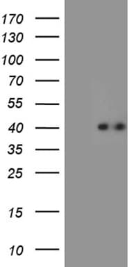 CHIA / Amcase Antibody (clone OTI3D8, Carrier-free)