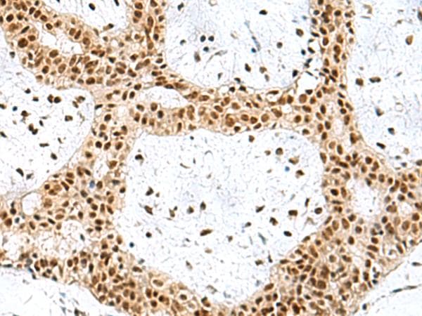 PRPF40A / FNBP3 Antibody