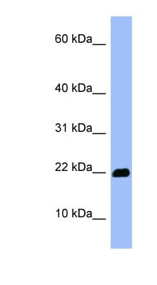 OMP Antibody (C-Terminus)