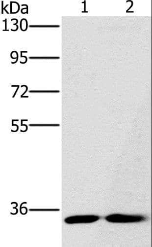 FAIM2 / LIFEGUARD Antibody
