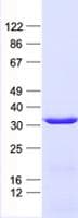 Human SLC25A1 / SEA Protein (Recombinant His, N-Terminal)