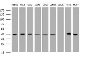 TBCC Antibody (clone OTI3A10)