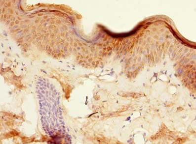 ZDHHC6 Antibody