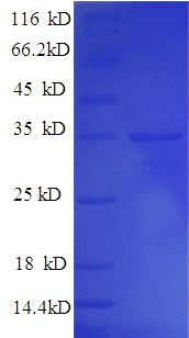 Bacillus thuringiensis Crystal Protein cry1Fb (Recombinant His)