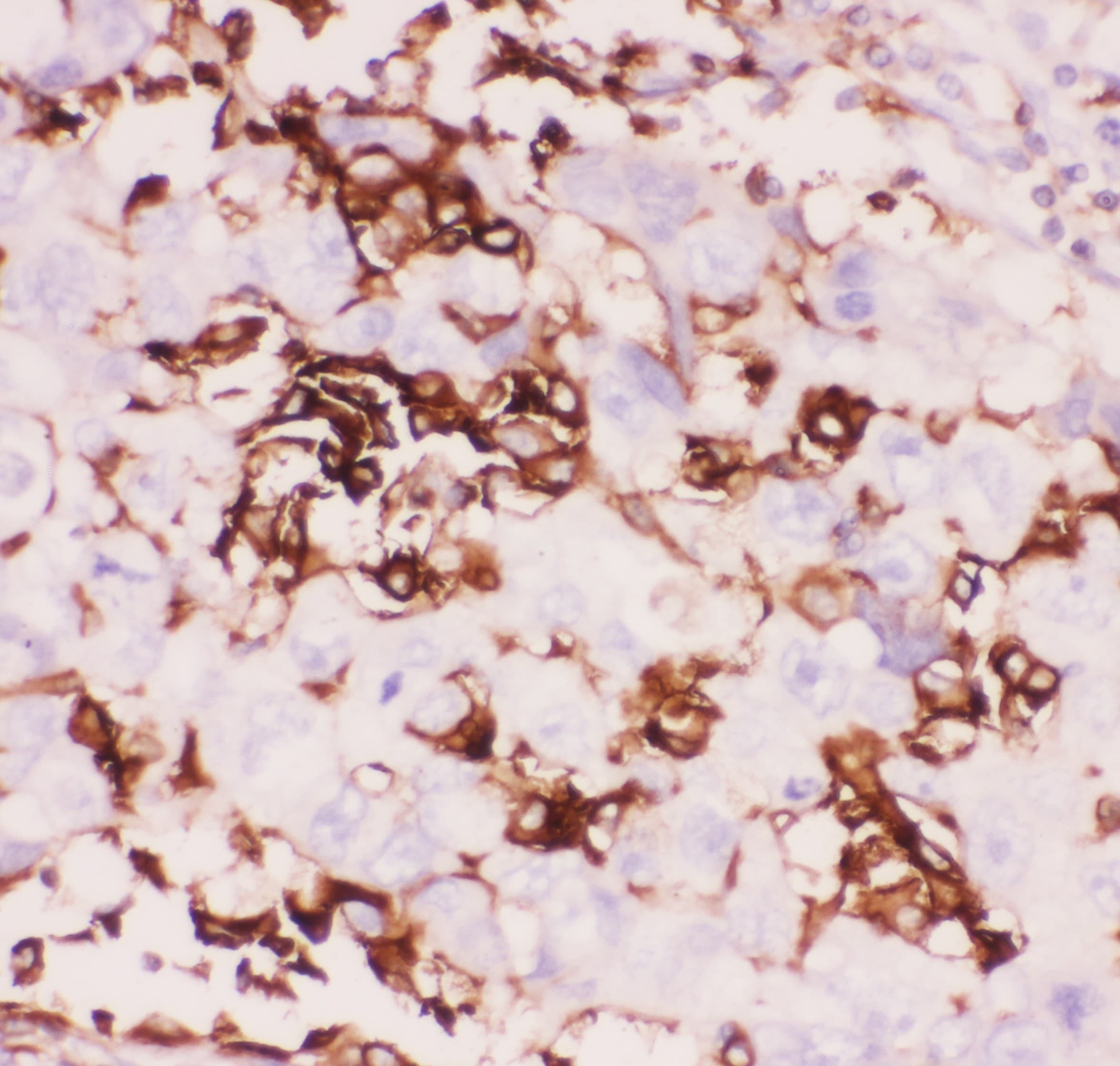 Polyclonal Rabbit anti-Human ITGB2 / CD18 Antibody (aa404-769, IHC, WB)