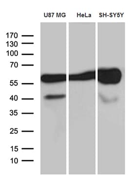 Monoclonal Mouse anti-Human GDI1 Antibody (clone OTI7F7, Carrier-free, WB)