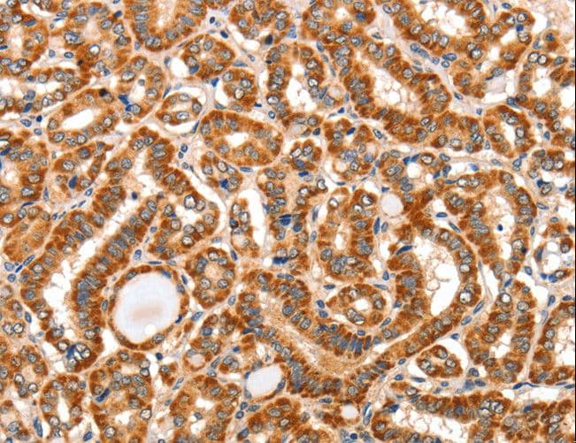 AIM2 Antibody