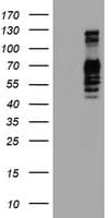 GOLM1 / GP73 / GOLPH2 Antibody (clone OTI2D6)