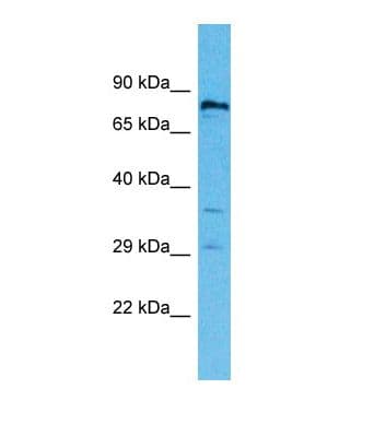 Polyclonal Rabbit anti-Human RNF19B Antibody (aa613-662, WB)