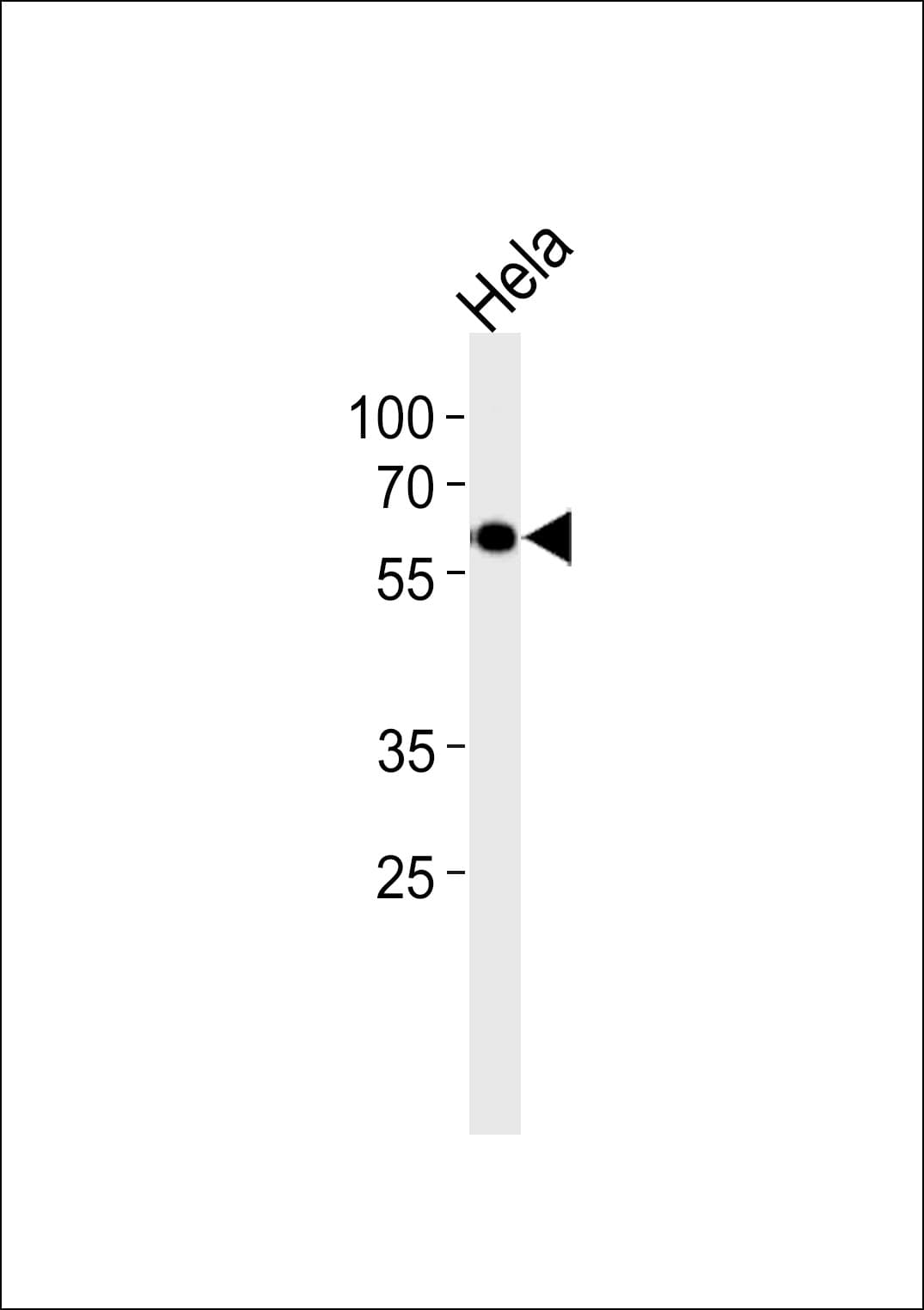 ESRRG / ERR Gamma Antibody (aa189-221)