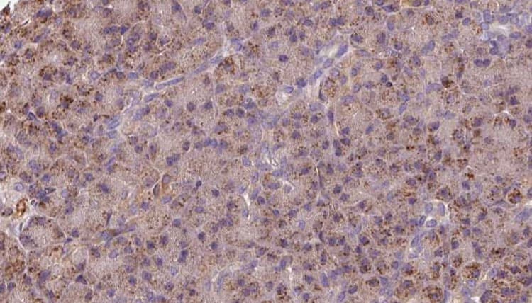Polyclonal Rabbit anti-Human GSTM3 Antibody (IHC, WB)