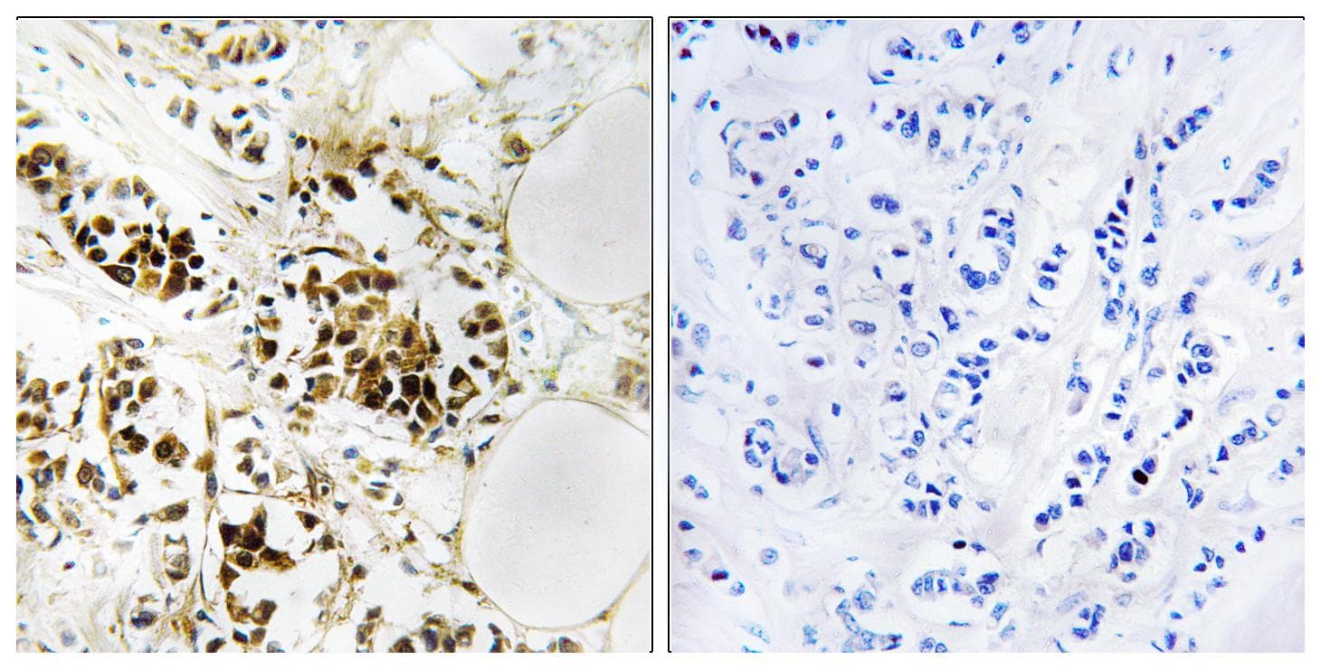 Polyclonal Rabbit anti-Human RGS5 Antibody (IHC, WB)