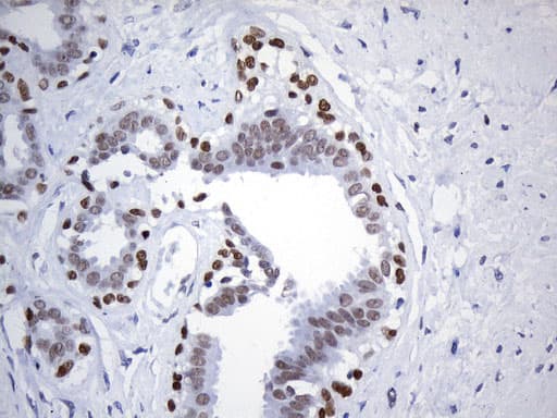 FOXP1 Antibody (clone UMAB242, Carrier-free)