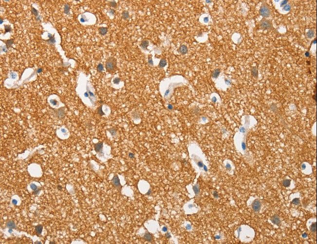 SNCA / Alpha-Synuclein Antibody