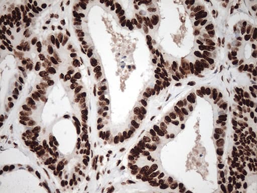TRIM28 / KAP1 Antibody (clone OTI7A4)