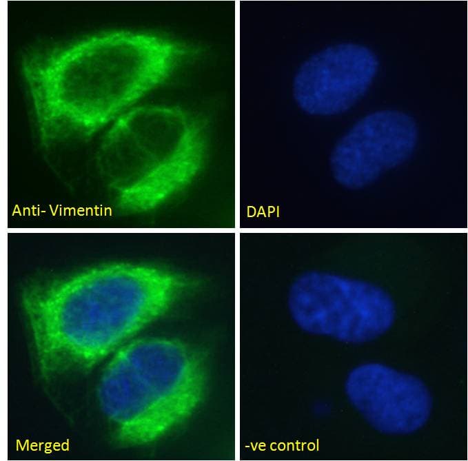 PathPlus™ Vimentin Antibody