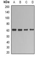 UGT1A / UGT1A1 Antibody