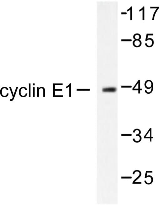 CCNE1 / Cyclin E1 Antibody (Ile119)