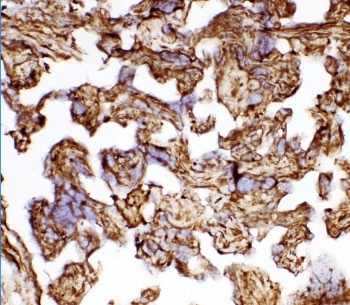 HSPB1 / HSP27 Antibody