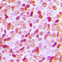 HDAC1 Antibody (C-Terminus)