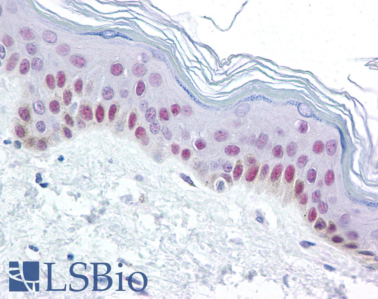 IHC-plus™ Monoclonal Mouse anti-Human XPC Antibody (clone 3.26, IHC, IF, WB)