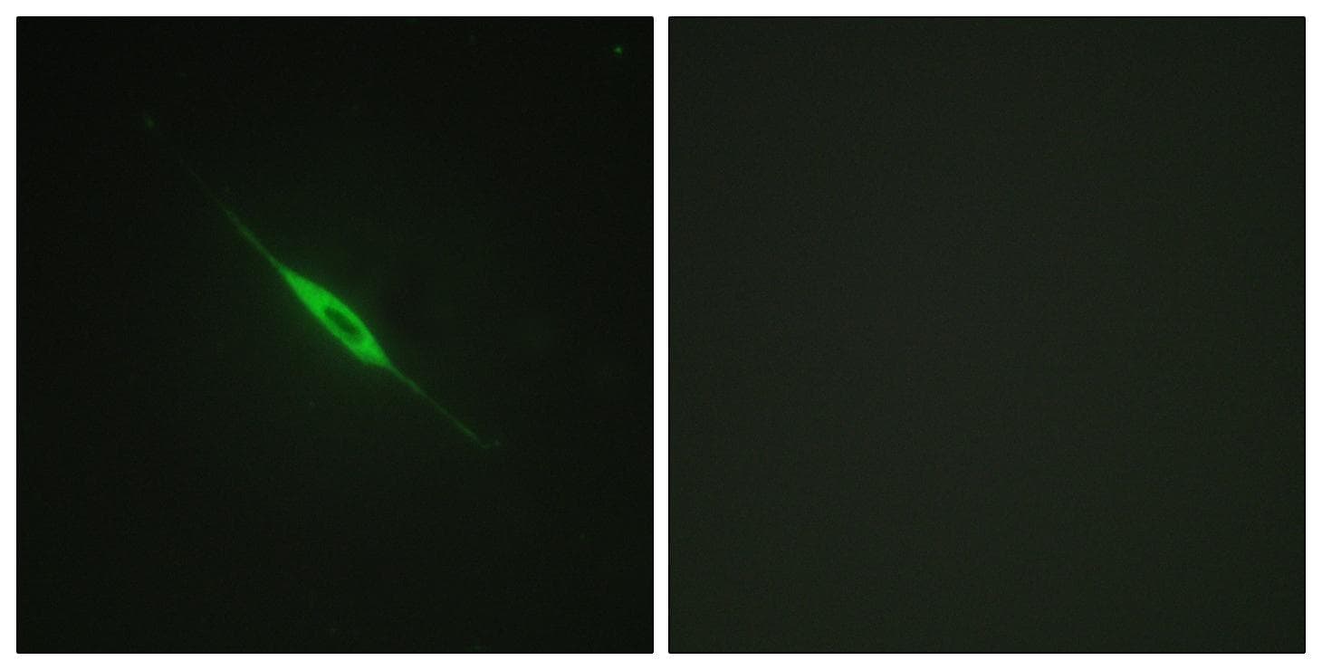 PRKCD / PKC-Delta Antibody (phospho-Tyr52)