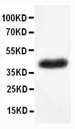 Polyclonal Rabbit anti-Human Basigin / Emmprin / CD147 Antibody (aa186-203, WB)