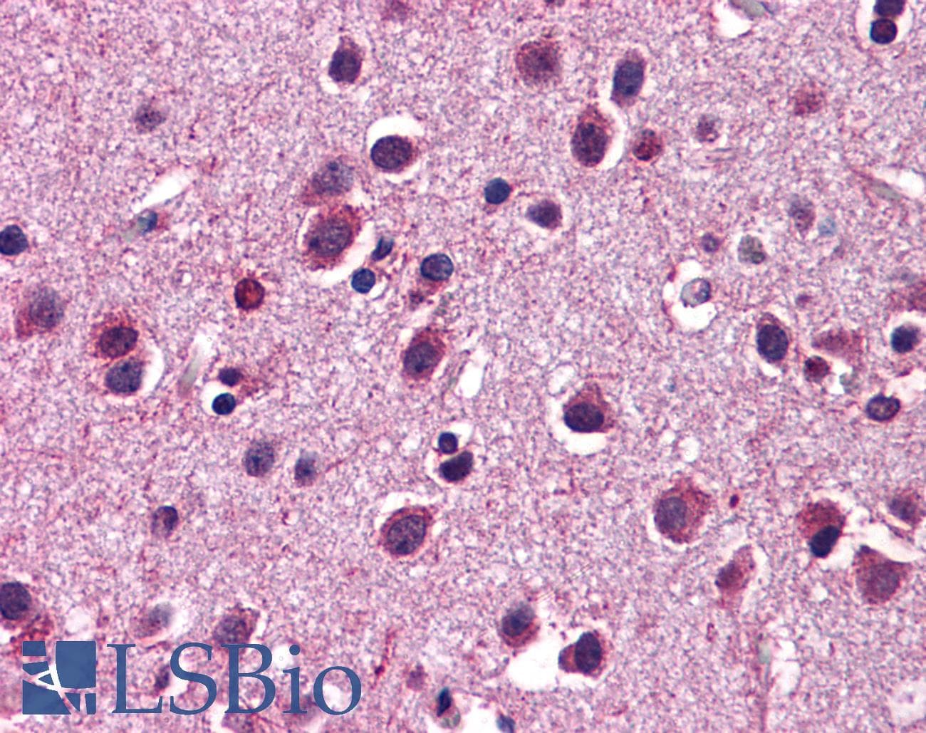 HTR3C / 5-HT3C Receptor Antibody (aa360-409)
