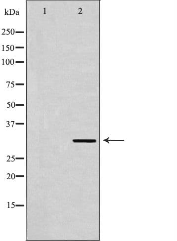 TPM2 Antibody