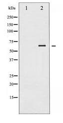 LIMK1 + LIMK2 Antibody